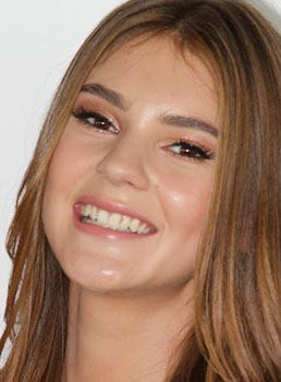 Stefanie Giesinger setzt jetzt auf Blond